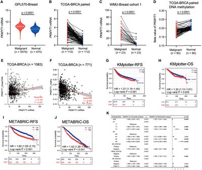 Overexpression of PKMYT1 associated with poor prognosis and immune infiltration may serve as a target in triple-negative breast cancer